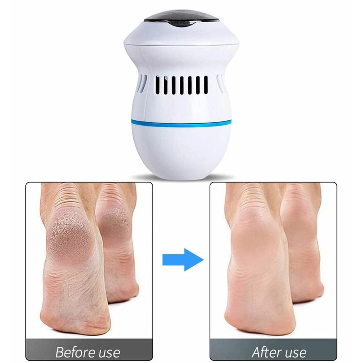 سنگ پا تخم مرغی callus remover